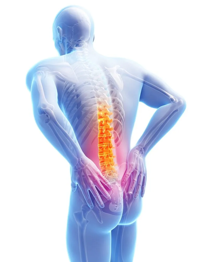 Why Choose Stellar Physio for Lower Back Pain & Spine Health Management in Nairobi?